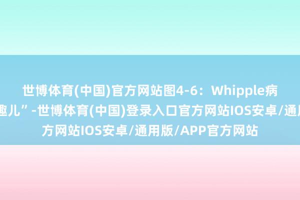世博体育(中国)官方网站图4-6：Whipple病的“白肠、白淋凑趣儿”-世博体育(中国)登录入口官方网站IOS安卓/通用版/APP官方网站