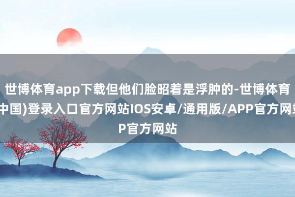世博体育app下载但他们脸昭着是浮肿的-世博体育(中国)登录入口官方网站IOS安卓/通用版/APP官方网站